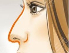 鹰钩鼻矫正大概需要多少钱？参考价格分享，拒绝被坑！