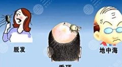 头顶加密会伤害原生发吗？科普了解植发手术，拒绝秃头！