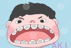 上海做牙齿矫正大概费用是多少？新价格表分享！隐形OR自锁，你挑~