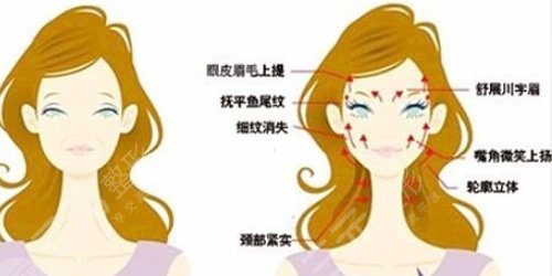 面部拉皮手术提升果和视频赏析，多久能够恢复？赶紧look