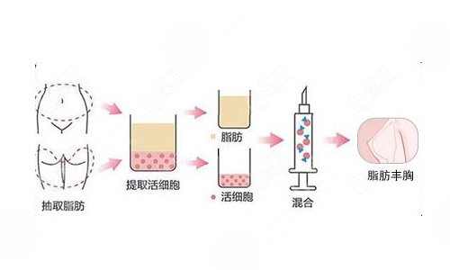 成都西区医院整形科热门项目科普