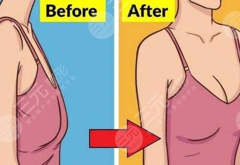 邓正军手术案例