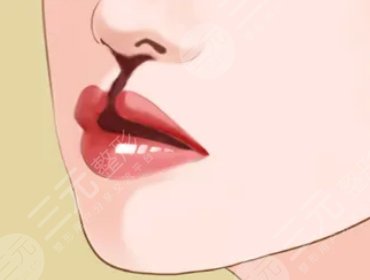 所在地区的因素