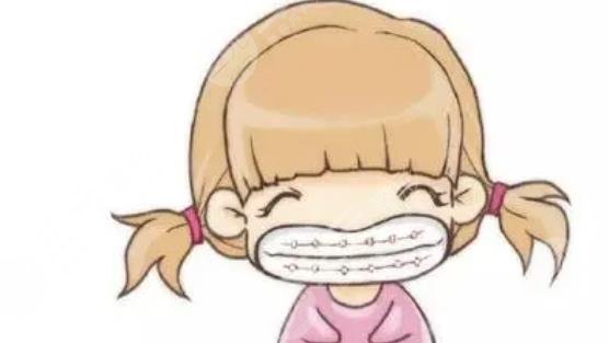 牙套