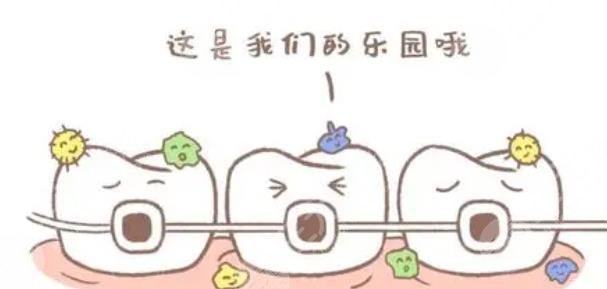 牙套