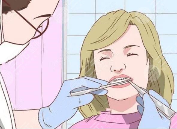 深圳牙齿矫正大概要花费多少钱？哪家医院比较好？排名+价格表