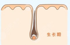 私密种植几天可以洗澡？毛发移植手术必备常识分享！这些事别去做！