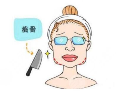 下颌角截骨