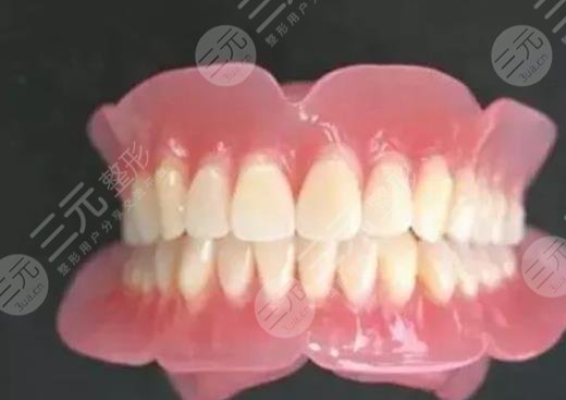 全口义齿