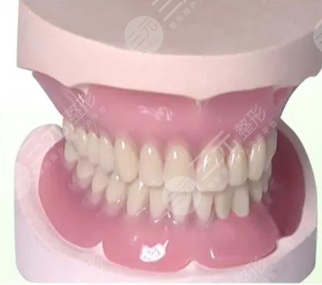 全口义齿