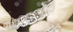 隐形牙套费用大概多少？新价目表出炉，正畸必看的攻略来袭！