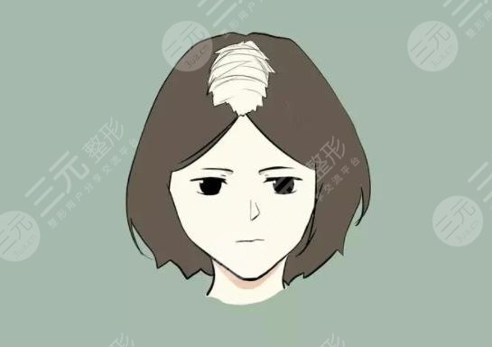 发际线