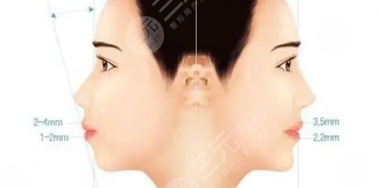 凸嘴