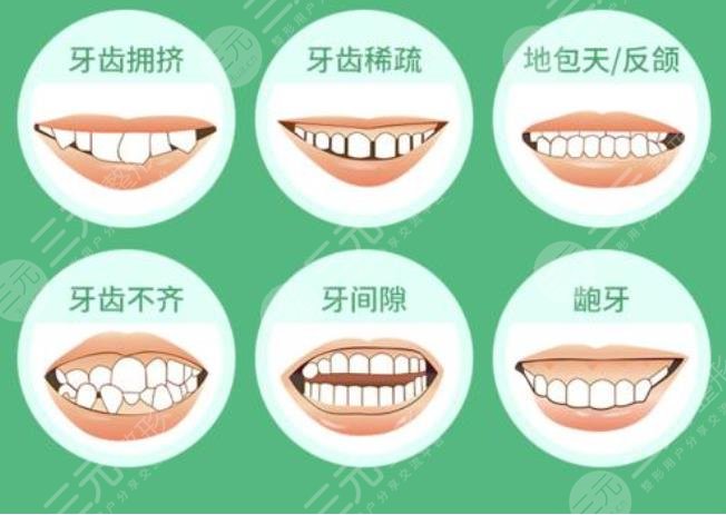 牙齿矫正