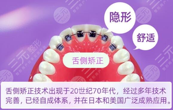 舌侧隐形矫正怎么样？价格参考+优点分析，来pick你的正畸攻略吧！