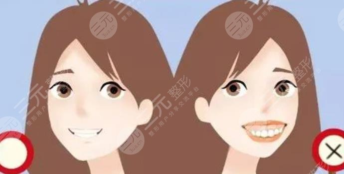 牙套矫正