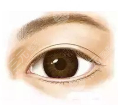 割双眼皮大概多久能恢复正常?需要多少钱一次?价位一览+术后护理 割双眼皮大概多久能恢复正常?需要多少钱一次?价位一览+术后护理