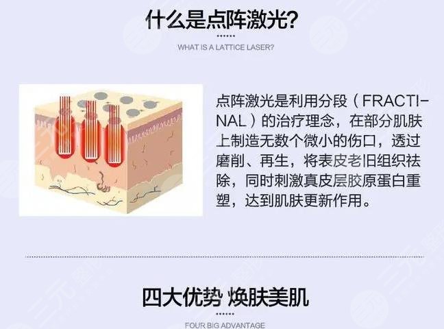 深圳市第二人民医院点阵激光手术果