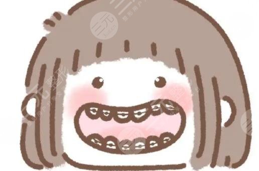 牙齿矫正