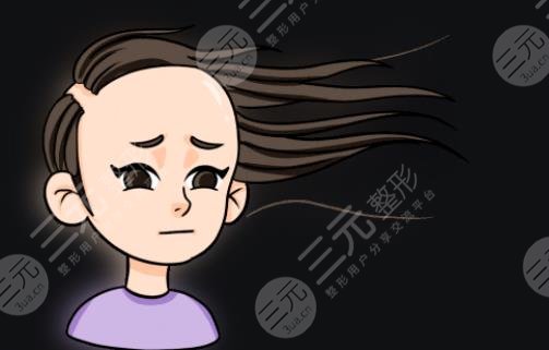 发际线