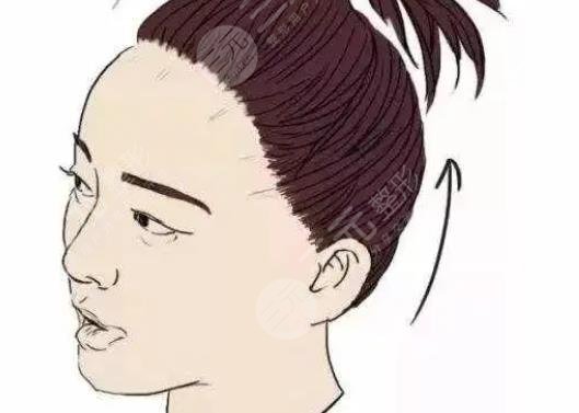 发际线