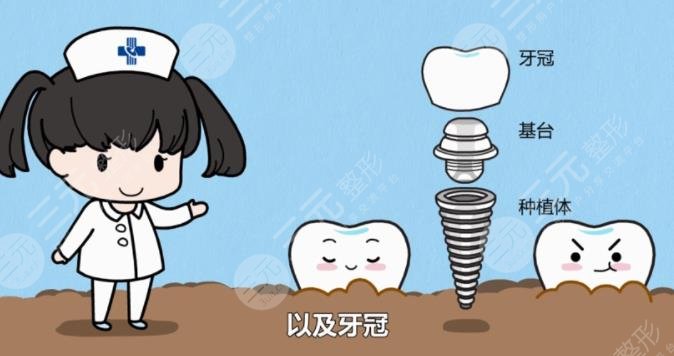 牙齿矫正