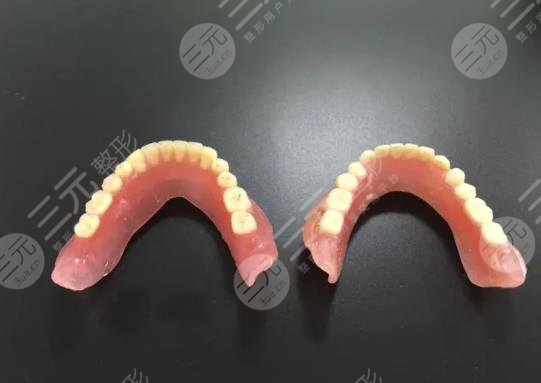 全口义齿