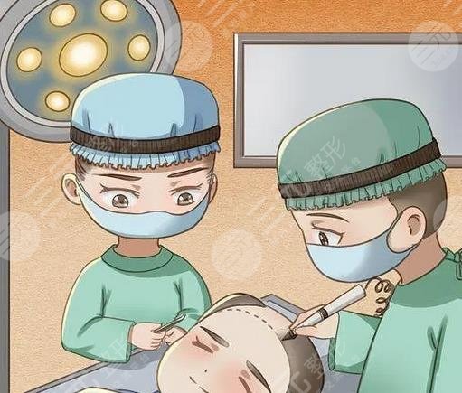 5000个毛囊植发的价格