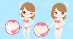 腰腹吸脂后1到7天图片分享,甩掉“水桶腰”过夏天 腰腹吸脂后1到7天图片分享,甩掉“水桶腰”过夏天