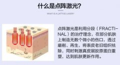深圳点阵激光多少钱一次？分享价格+祛痘案例，你值得pick！