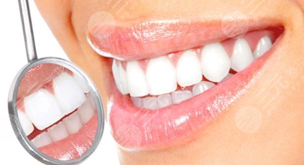 烤瓷牙多少钱一颗价格表2021-2022