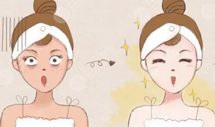 点阵激光5次做完后图片