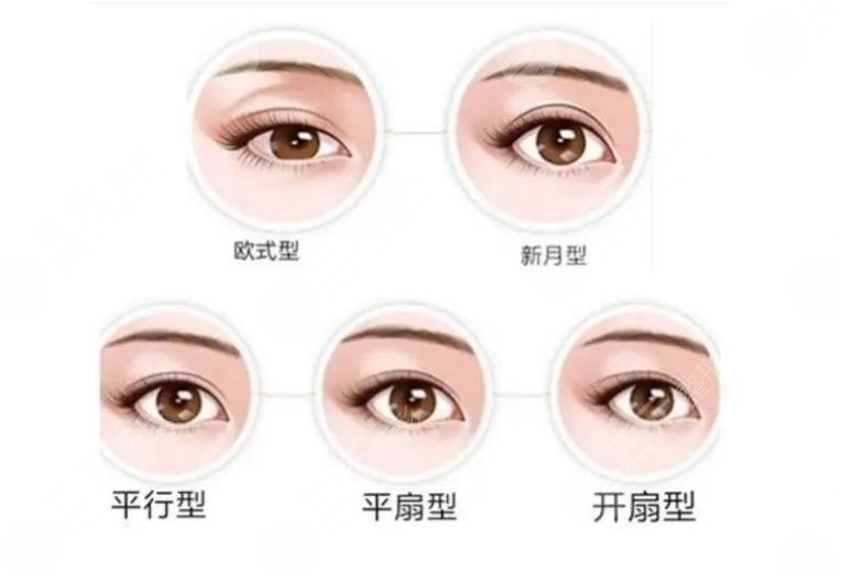 割双眼皮十个有九个后悔真的吗?3点术前了解事宜盘点!