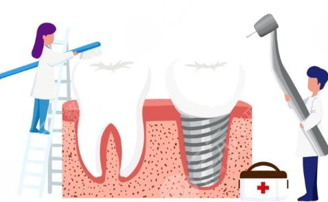 韩国奥齿泰种植牙术后护理事项