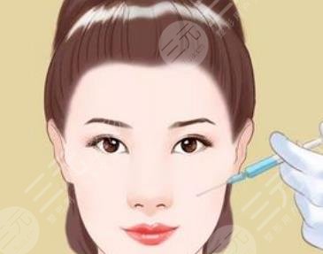 面部填充