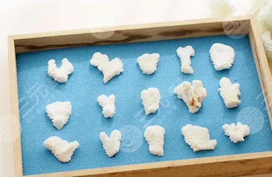 珊瑚骨隆鼻