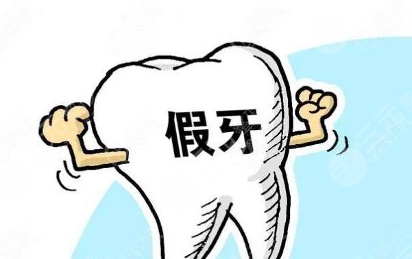 全口吸附性义齿