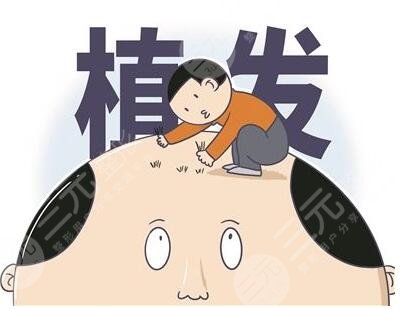 植发技术有哪些特点?