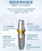 牙种植体什么牌子的好?介绍10个“高大上”的品牌,任你挑! 牙种植体什么牌子的好?介绍10个“高大上”的品牌,任你挑!