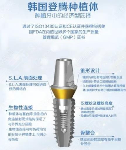 牙种植体什么牌子的好