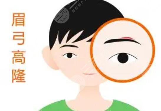 填充眉弓