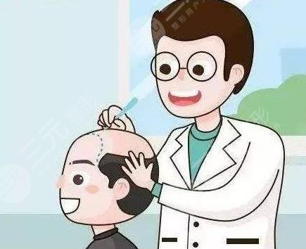 发际线改良种植手术