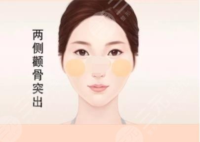 颧骨磨骨