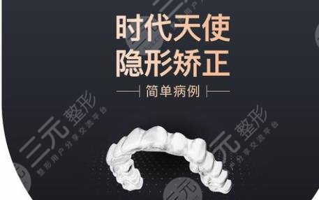 时代天使版