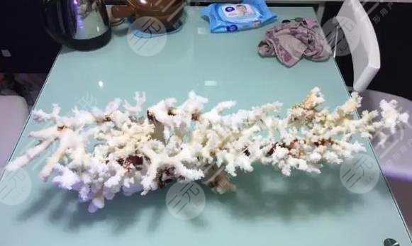 珊瑚骨