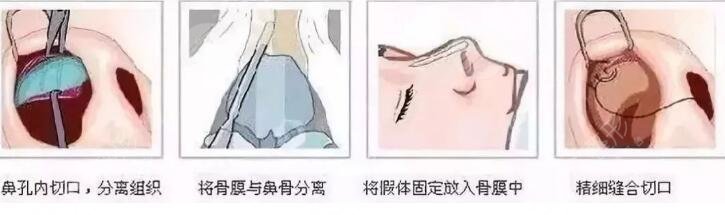 厦门海峡张宏做科普