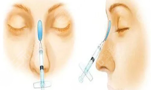 上海第九人民医院整形专家排名