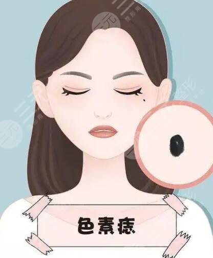 祛痣后10天恢复图片