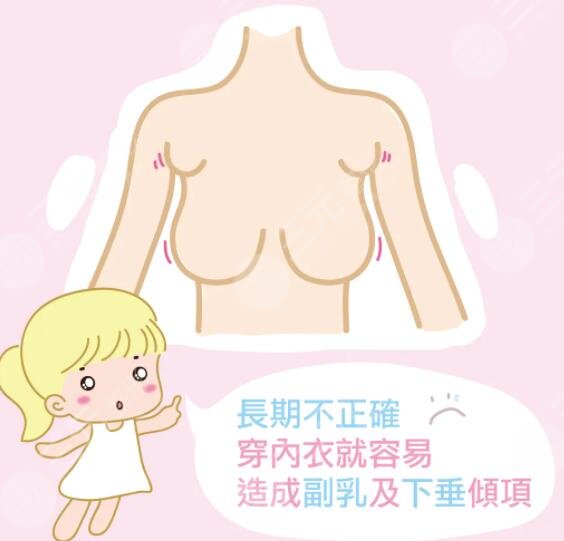 切除副乳手术后第五天