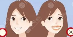 深圳整牙齿需要多少钱，哪个医院好？参考均价出炉，这2家口腔专科可选！